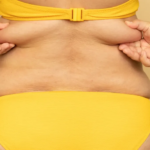 Hormonal Belly Fat: Why It’s So Hard to Lose After 40