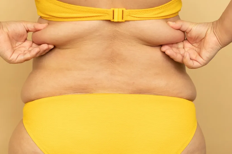 Read more about the article Hormonal Belly Fat: Why It’s So Hard to Lose After 40